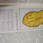 Фото №6 Книга. Кардиология детского возраста. СССР.