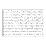 фото Бумага для электроэнцефалографов (ЭЭГ) - ТД АРМАДА