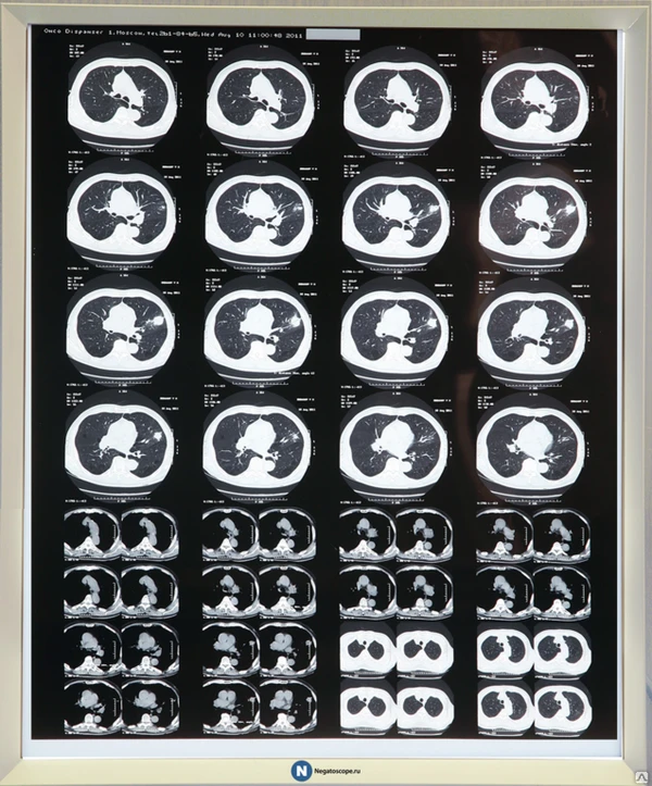 Фото Негатоскоп однокадровый