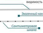 фото Аспирационная игла для пункции кисты SOL